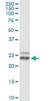 Anti-TFAM Polyclonal Antibody Pair