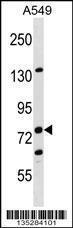 Anti-LIMA1 Rabbit Polyclonal Antibody (APC (Allophycocyanin))