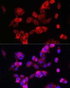 Immunofluorescence analysis of HepG2 cells using Anti-CYP7A1 Antibody (A8675) at a dilution of 1:100 (40X lens). DAPI was used to stain the cell nuclei (blue)