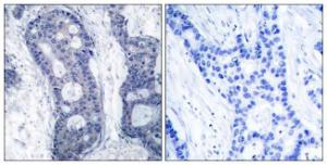 Anti-eIF4E antibody