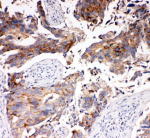 Anti-SLC16A4 Rabbit Polyclonal Antibody