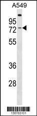 Anti-GBP3 Rabbit Polyclonal Antibody (FITC (Fluorescein Isothiocyanate))