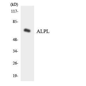 Western blot analysis of the lysates from Jurkat cells using Anti-ALPL Antibody