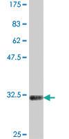 Anti-NKX3-2 Mouse Polyclonal Antibody