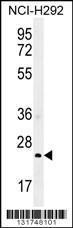 Anti-GSTA3 Rabbit Polyclonal Antibody