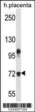 Anti-FBLN1 Rabbit Polyclonal Antibody (AP (Alkaline Phosphatase))