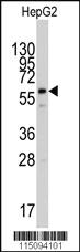 Anti-PPAT Rabbit Polyclonal Antibody