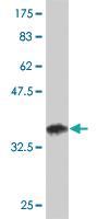 Anti-SYNE2 Mouse Monoclonal Antibody [clone: 5E5]