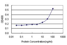 Anti-CXCL1 Antibody Pair