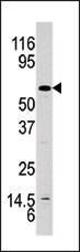 Anti-AKT1 Rabbit Polyclonal Antibody (FITC (Fluorescein Isothiocyanate))