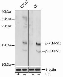 Western blot analysis of extracts of various cell lines, using Anti-Phospholamban (phospho Ser16) Antibody (A93031) at 1:1000 dilution