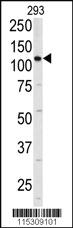 Anti-ITGA6 (isoform 2) Rabbit Polyclonal Antibody