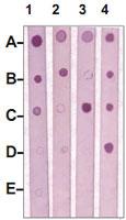 Anti-MST1R Rabbit Polyclonal Antibody