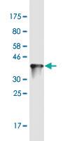 Anti-ZNF100 Mouse Monoclonal Antibody [clone: 3C3]