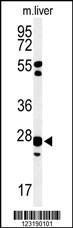 Anti-GSTK1 Rabbit Polyclonal Antibody (AP (Alkaline Phosphatase))