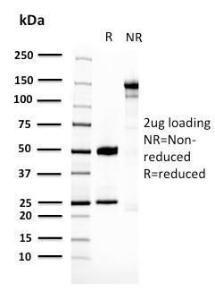 SDS-PAGE analysis of Anti-14-3-3E Antibody [CPTC-YWHAE-1] under non-reduced and reduced conditions; showing intact IgG and intact heavy and light chains, respectively. SDS-PAGE analysis confirms the integrity and purity of the antibody.