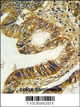 Anti-ITGA6 (isoform 2) Rabbit Polyclonal Antibody