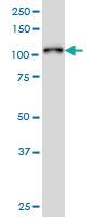 Anti-PTK2B Mouse Monoclonal Antibody [clone: 1F9]