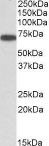 Anti-ERO1L antibody