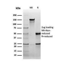 Anti-HSP27 antibody