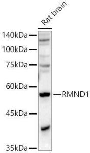 Western blot analysis of Rat brain, using Anti-RMND1 Antibody (A306185) at 1:500 dilution The secondary antibody was Goat Anti-Rabbit IgG H&L Antibody (HRP) at 1:10,000 dilution Lysates/proteins were present at 25 µg per lane