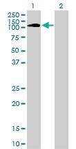 Anti-PTK2B Mouse Monoclonal Antibody [clone: 1F9]