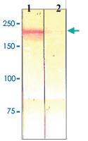 Anti-MST1R Rabbit Polyclonal Antibody