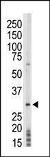 Anti-TP53RK Rabbit Polyclonal Antibody (HRP (Horseradish Peroxidase))