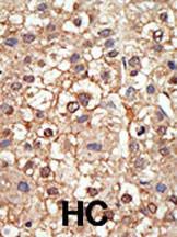 Anti-PIAS4 Rabbit Polyclonal Antibody (FITC (Fluorescein Isothiocyanate))