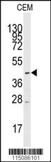 Anti-SLC16A1 Rabbit Polyclonal Antibody