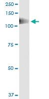 Anti-PTK2B Mouse Monoclonal Antibody [clone: 1F9]