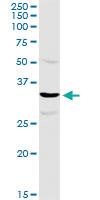 Anti-TTC1 Rabbit Polyclonal Antibody