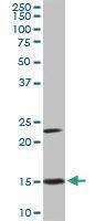 Anti-RPS17 Mouse Monoclonal Antibody [clone: 2C7]