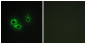 Immunofluorescence analysis of COS7 cells using Anti-AGR3 Antibody. The right hand panel represents a negative control, where the Antibody was pre-incubated with the immunising peptide