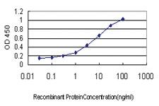 Anti-PTK2B Mouse Monoclonal Antibody [clone: 1F9]