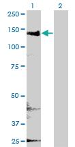 Anti-CYFIP2 Mouse Monoclonal Antibody [clone: 4G6]