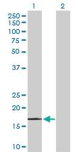 Anti-PPP1R14A Rabbit Polyclonal Antibody