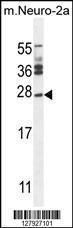 Anti-JOSD2 Rabbit Polyclonal Antibody (Biotin)