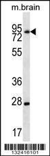 Anti-LIMD1 Rabbit Polyclonal Antibody (Biotin)