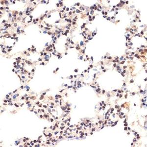 Immunohistochemistry analysis of paraffin-embedded rat lung using Anti-EHMT2/G9A Antibody [ARC2470] (A305253) at a dilution of 1:100 (40X lens). Perform microwave antigen retrieval with 10 mM Tris/EDTA buffer pH 9.0 before commencing with IHC staining protocol