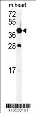 Anti-TBC1D3H Rabbit Polyclonal Antibody