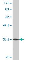 Anti-SNAI2 Mouse Monoclonal Antibody [clone: 3G9]