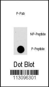 Anti-AKT1 Rabbit Polyclonal Antibody (Biotin)