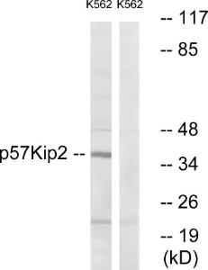 Western blot analysis of lysates from K562 cells using Anti-p57 Kip2 Antibody. The right hand lane represents a negative control, where the antibody is blocked by the immunising peptide.