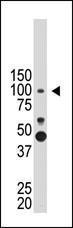 Anti-PROX1 Rabbit Polyclonal Antibody (AP (Alkaline Phosphatase))