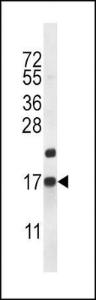 Anti-CARTPT Rabbit Polyclonal Antibody (APC (Allophycocyanin))