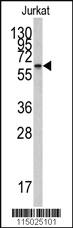 Anti-CYP26A1 Rabbit Polyclonal Antibody