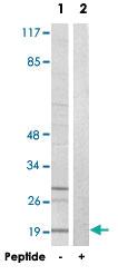 Anti-PBOV1 Rabbit Polyclonal Antibody