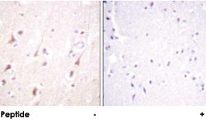 Anti-IRS1 Rabbit Polyclonal Antibody