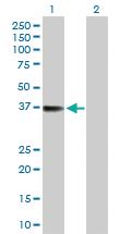 Anti-TTC1 Rabbit Polyclonal Antibody